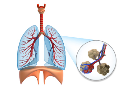 Krioablacija može pomoći u uništavanju stanica raka pluća