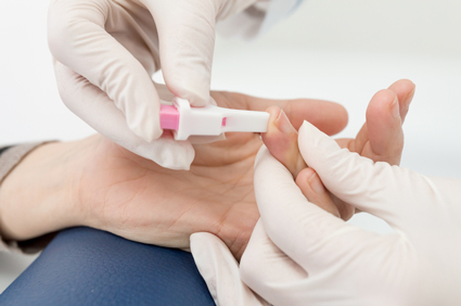 Krvni test može trudnicama s lupusom predvidjeti rizik od komplikacija