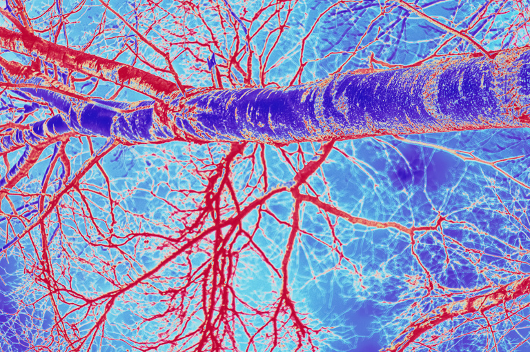 Laboratorijski uzgojene krvne žile mozga mogu pomoći u prevenciji moždanog udara i demencije