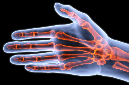 Liječenje reumatoidnog artritisa manje učinkovito u pretilih bolesnika