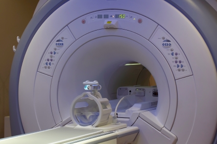 Magnetska rezonancija pospješuje otkrivanje skrivenih karcinoma dojke
