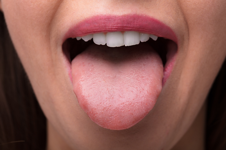 Mikrobi na jeziku mogu se koristiti za dijagnosticiranje raka gušterače
