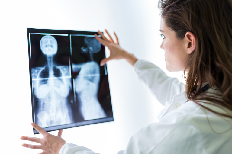 Mlađe pacijentice s rakom dojke izložene većem riziku od osteoporoze