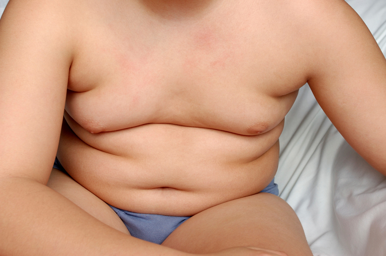 Mnoga djeca s prekomjernom tjelesnom težinom već imaju otvrdnute arterije i dijabetes