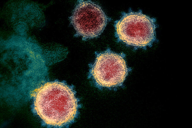 Najmanje deset novozaraženih novim koronavirusom u Hrvatskoj