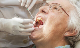 Nedostatak dentalne skrbi povezan s većim rizikom od srčanih bolesti i demencije