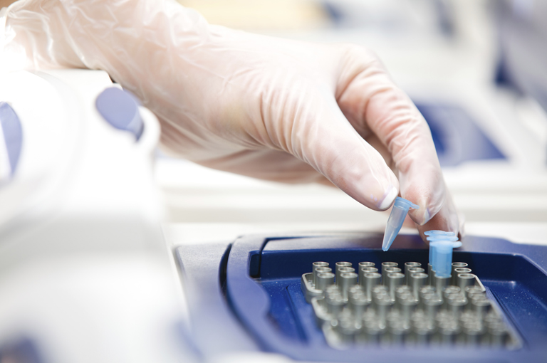 Niže cijene PCR testiranja na COVID-19 i serološkog testiranja koje plaća HZZO