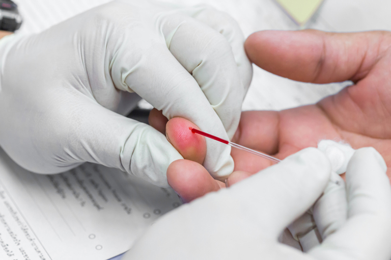 Niže razine hemoglobina unutar normalnog raspona povezane s boljim metaboličkim zdravljem