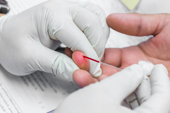 Niže razine hemoglobina unutar normalnog raspona povezane s boljim metaboličkim zdravljem