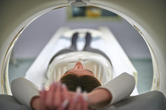 Nova metoda snimanja razlikuje upalu od plućne fibroze