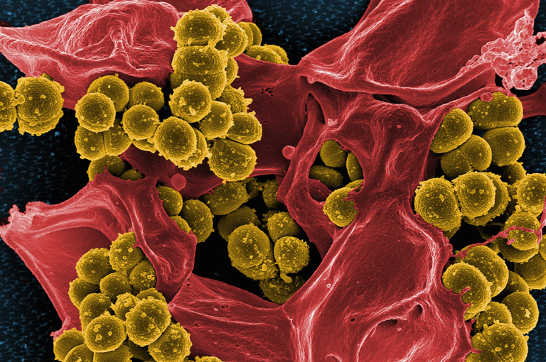 Nova tehnologija uspješno probija MRSA biofilmove