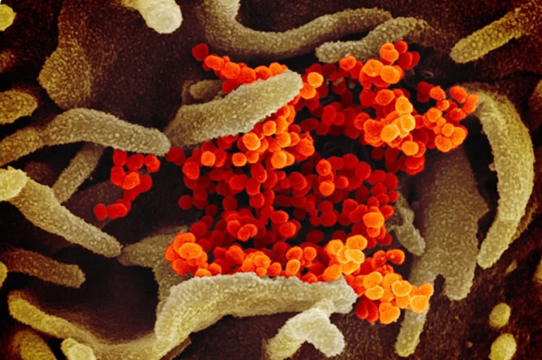 Novi koronavirus može satima ostati u zraku, a na površinama danima 
