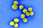 Novi koronavirus SARS-CoV-2 može uzrokovati bolnu infekciju štitnjače 