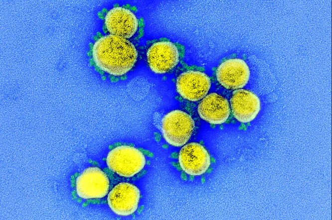 Novi koronavirus SARS-CoV-2 prisutan u zraku unutar 4 metra od zaražene osobe