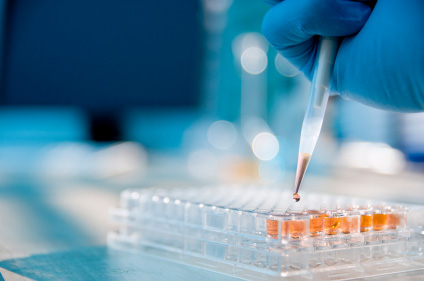 Novi krvni test mogao bi pomoći u ranijem otkrivanju raka gušterače