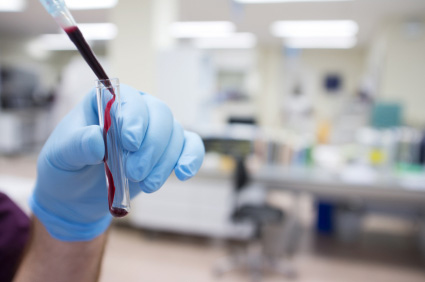 Novi krvni test može otkriti ozbiljne zdravstvene rizike u žena