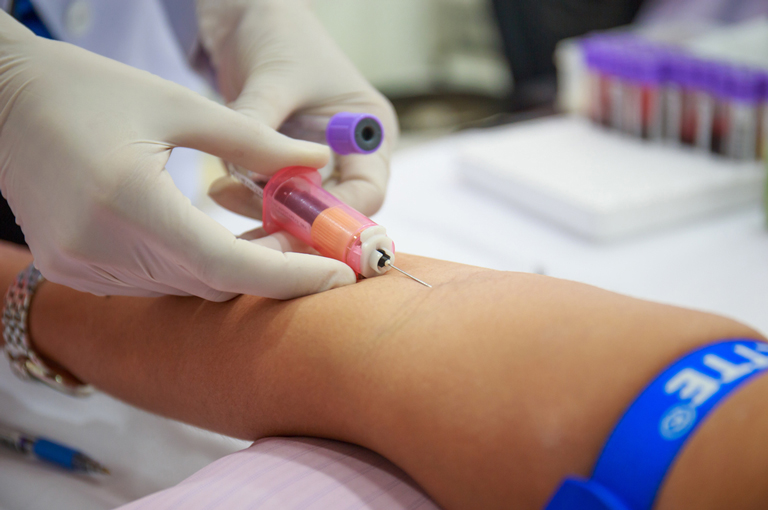 Novi krvni test može otkriti rak godinama ranije