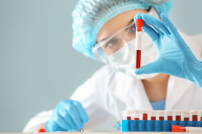 Novi test krvi poboljšava ranu dijagnozu raka gušterače