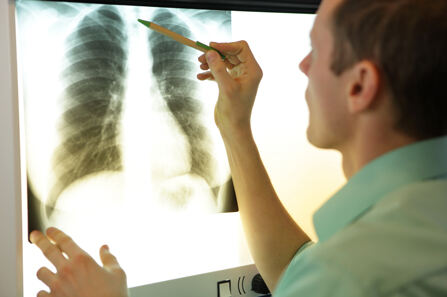 Obilježavanje Svjetskog tjedna idiopatske plućne fibroze 