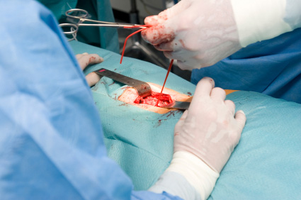 Operacije crvuljka i žučnog mjehura sigurne u trudnoći