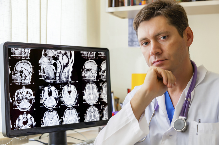 Opsežna upala mozga uočena kod pacijenata s fibromialgijom
