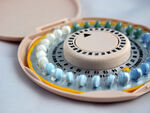 Oralni kontraceptivi dobar izbor za liječenje akni u žena