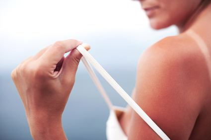 Pet ili više težih opeklina od sunca tijekom mladosti povećavaju rizik od melanoma