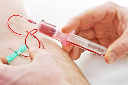 Pomoću novog krvnog testa može se brže otkriti srčani udar