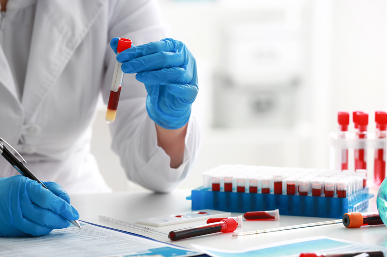 Povišene razine pet proteina u krvi mogu pomoći u predviđanju rizika od smrti