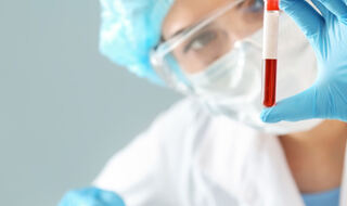 Povišeni tau protein kod pacijenata s dugotrajnim COVID-19 povećava rizik od neurodegenerativnih bolesti