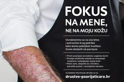 Predstavljeni rezultati prvog istraživanja o kvaliteti života osoba oboljelih od psorijaze u Hrvatskoj