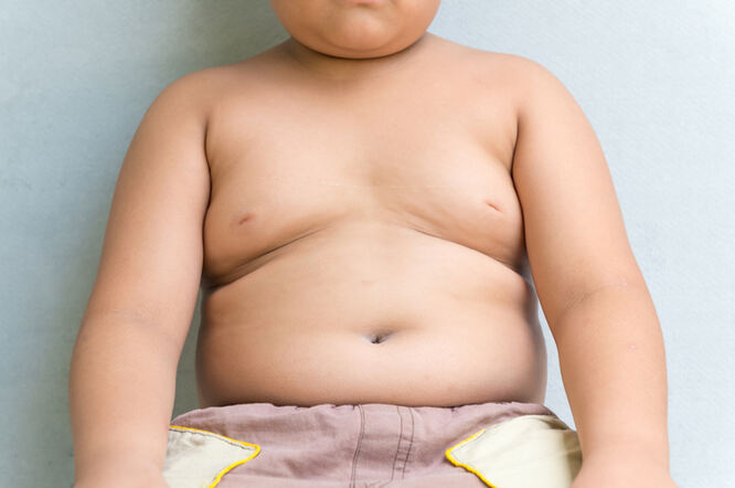 Pretilost u djetinjstvu može biti čimbenik rizika za sve vrste dijabetesa u odrasloj dobi
