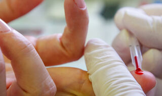 Profiliranje proteina plazme može pomoći u otkrivanju raka kod pacijenata s nespecifičnim simptomima