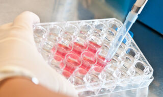 Protein ACE2 može igrati zaštitnu ulogu protiv visokog krvnog tlaka i dijabetesa tipa 2