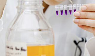 Protein dobiven iz jetre podržava zdravlje kostiju kod muškaraca