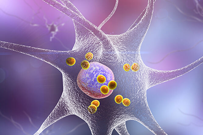Protein mozga ima ulogu u razvoju i rastu raka gušterače