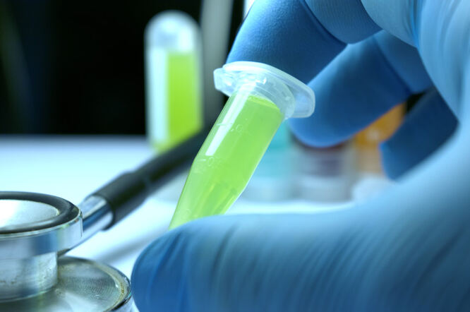 Rana primjena imunoterapije poboljšava stopu odgovora uznapredovalog bazocelularnog karcinoma