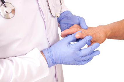Reumatoidni artritis povećava rizik od venske tromboembolije