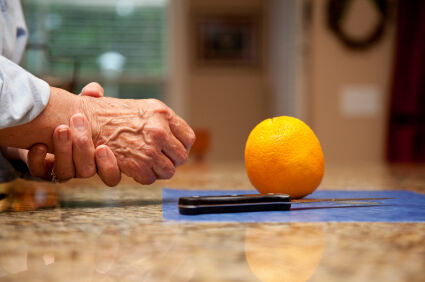 Reumatoidni artritis povezan s većim rizikom od razvoja krvnih ugrušaka