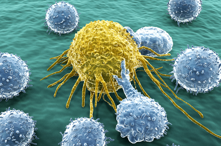Stanice raka dojke mogu reprogramirati NK stanice da pomognu u metastaziranju