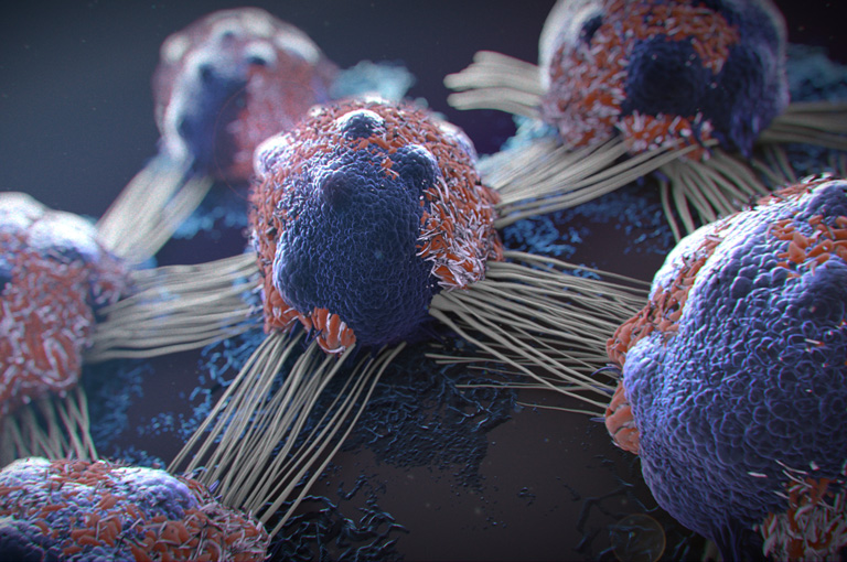 Stanice raka proizvode malu količinu kolagena koji utječe na tumorski mikrobiom i imunitet