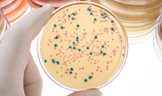 Teške infekcije povezane s većim rizikom od demencije