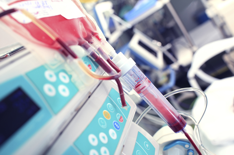 Trudnice s anemijom vjerojatnije će trebati transfuziju krvi nakon poroda carskim rezom