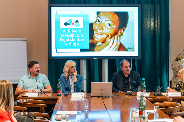 U Hrvatskoj oko 45.000 osoba živi s vitiligom