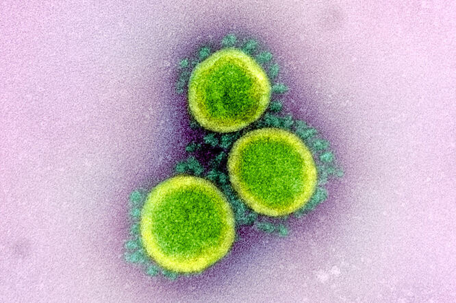 U Hrvatskoj trenutno na respiratoru 278 COVID-19 pacijenata