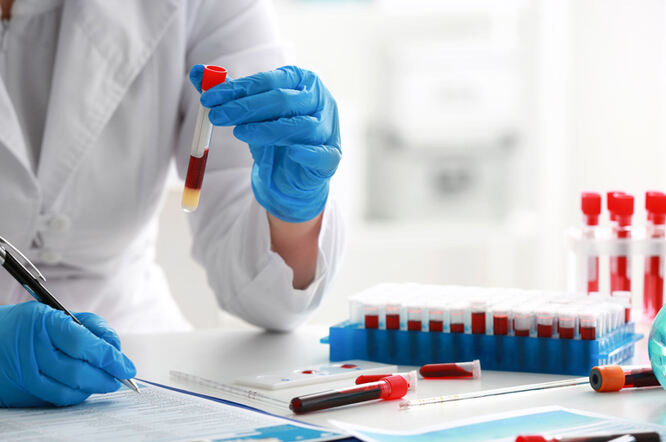Zamjena ugljikohidrata proteinima i mastima poboljšava profile lipoproteina kod dijabetesa tipa 2