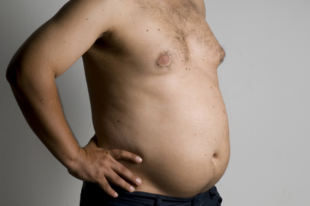 Znatno povećanje tjelesne težine u odrasloj dobi povećava rizik od karcinoma